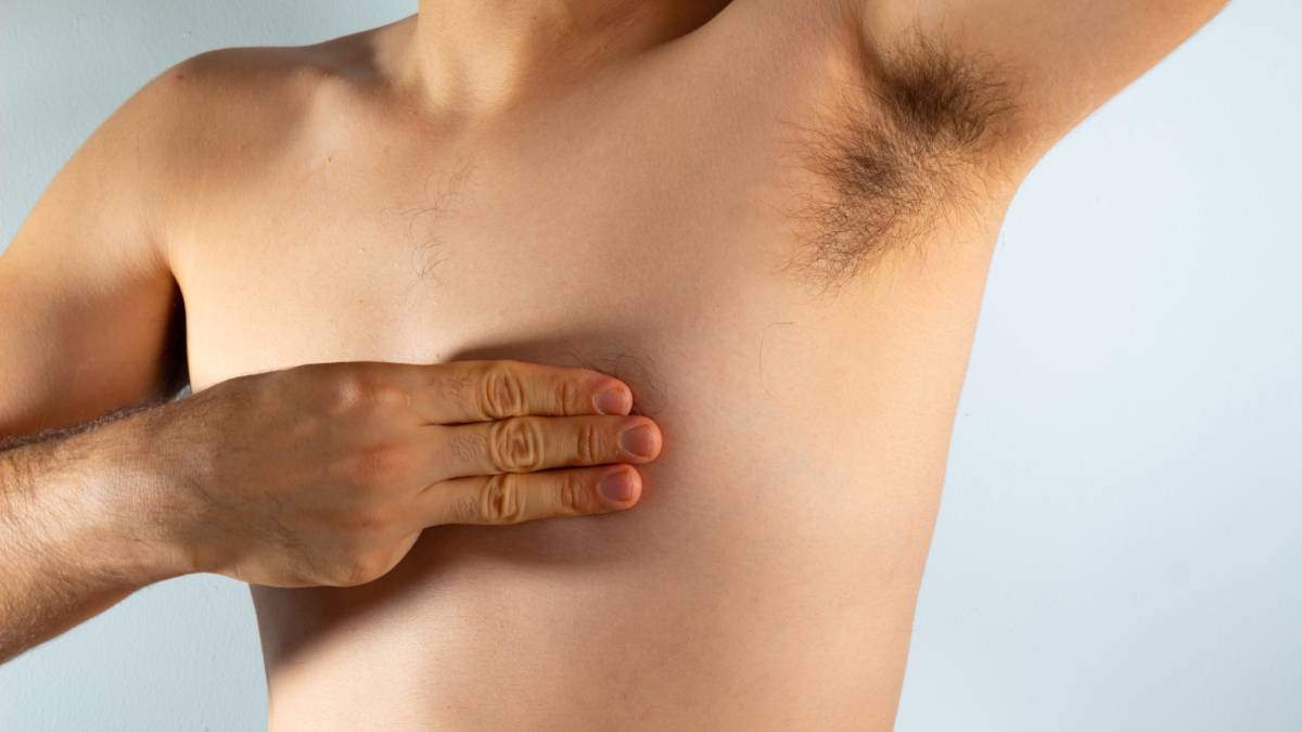 Male breast cancer